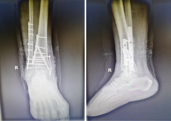 图片4.png 图片4.png