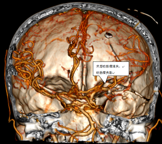 640 (3).png 640 (3).png