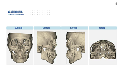 图片33.png 图片33.png