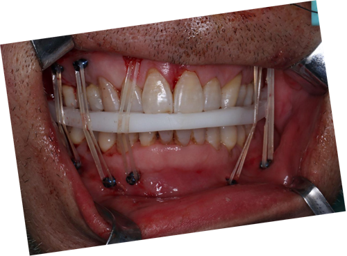 图片38.png 图片38.png